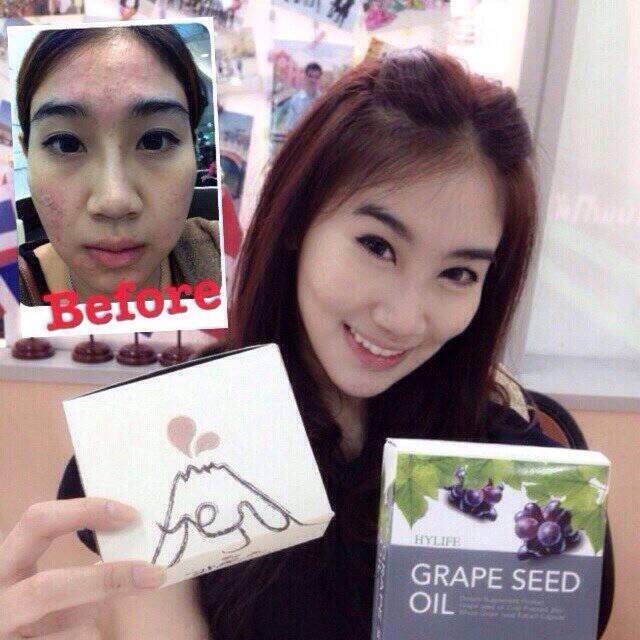 น้ำมันองุ่นสกัดเย็น Grape seed oil สร้างภูมคุ้มกัน ต่อต้านอนุมูลอิสระ รูปที่ 1