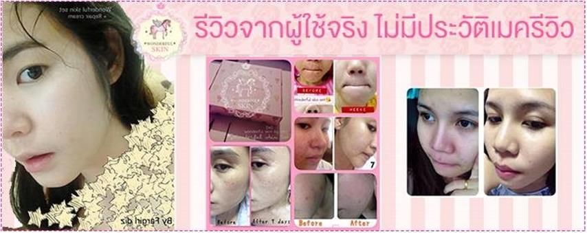 ครีมหน้าใสผลิตภัณฑ์เพื่อผิวขาวและเสื้อผ้าแฟชั่นราคาถูก รูปที่ 4