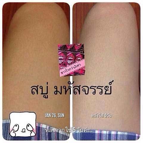สบู่ผิวขาว สบู่มหัศจรรย์ สบู่ที่สร้างความมหัศจรรย์ห้แก่ผิวคุณ  ปลอดภัยขาวไว 2 เท่า รูปที่ 7