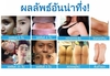 รูปย่อ ไฟโตเอสซี รูปที่3