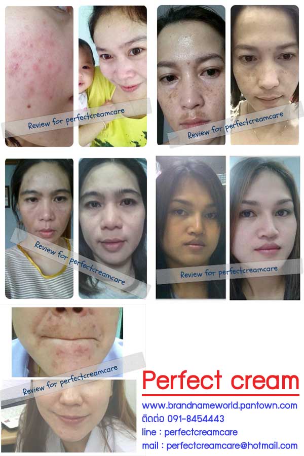 perfect cream ครีมหน้าขาวเนียนใสดุจผิวเด็ก ครีมรักษาฝ้า กระ สิว รอยดำ หมองคล้ำหายไป รูปที่ 1