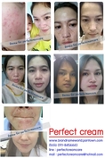 perfect cream ครีมหน้าขาวเนียนใสดุจผิวเด็ก ครีมรักษาฝ้า กระ สิว รอยดำ หมองคล้ำหายไป