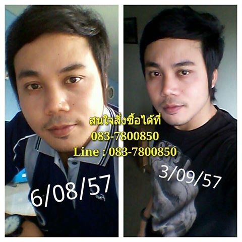 ครีมถุงทองหน้าใส รูปที่ 2