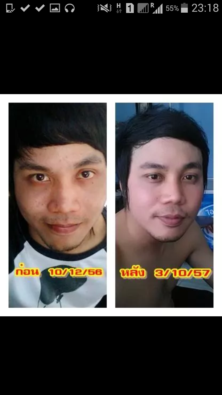 ครีมถุงทองหน้าใส รูปที่ 6