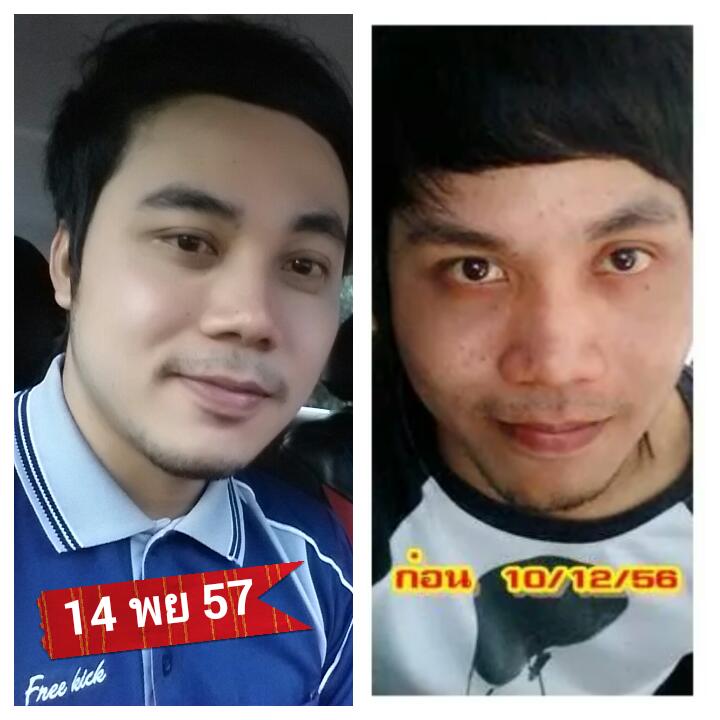 ครีมถุงทองหน้าใส รูปที่ 7