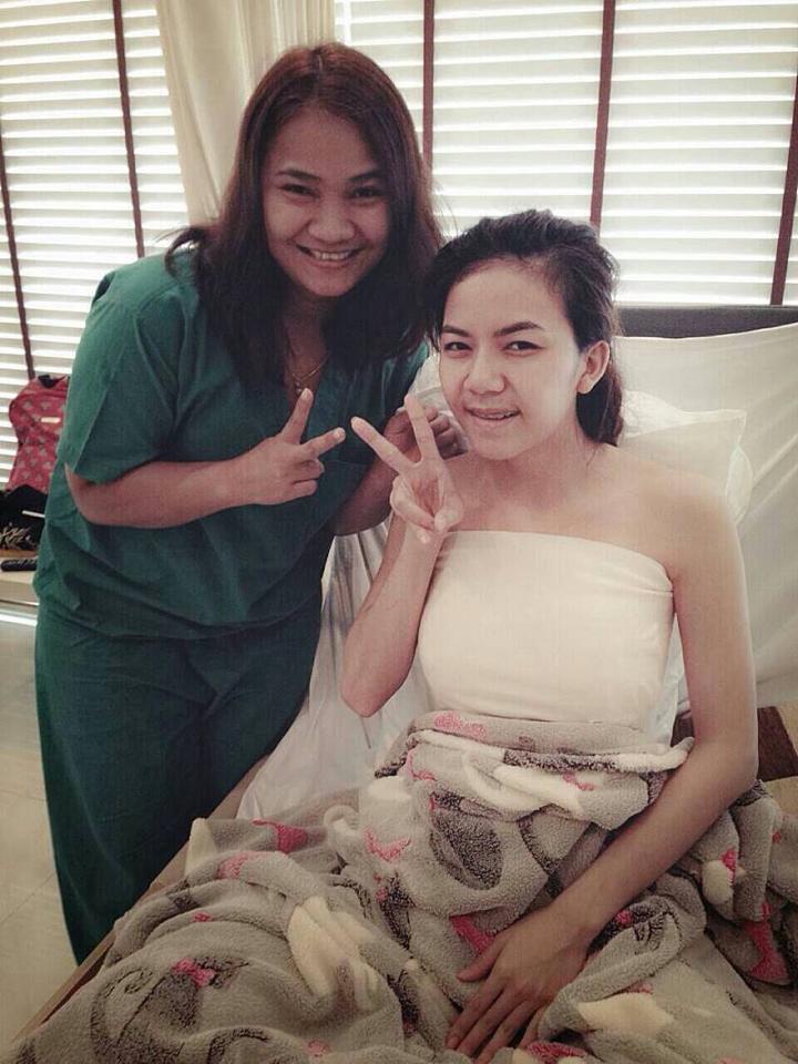 เสริมหน้าอก หน้าอกหยดน้ำ bb clinic (จ๊ะ อาร์สยามทำ)ซิลิโคน usa mentor ติดต่อแมว(พยาบาล)0653545163 รูปที่ 7