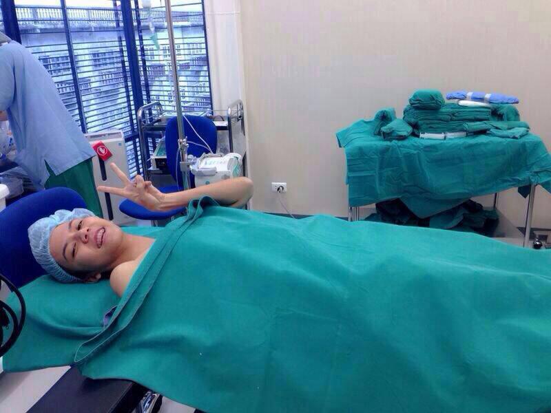 เสริมหน้าอก หน้าอกหยดน้ำ bb clinic (จ๊ะ อาร์สยามทำ)ซิลิโคน usa mentor ติดต่อแมว(พยาบาล)0653545163 รูปที่ 2