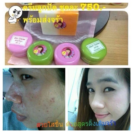 ครีมลูกปัดแพคเก็จใหม่ ครีมหน้าขาวใส ไร้สิว ฝ้า-กระ จุดด่างดำหายเกลี้ยง รีวิวล้นหลามจร้าา รูปที่ 4