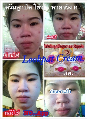 ครีมลูกปัดแพคเก็จใหม่ ครีมหน้าขาวใส ไร้สิว ฝ้า-กระ จุดด่างดำหายเกลี้ยง รีวิวล้นหลามจร้าา รูปที่ 7