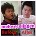 รูปย่อ คลอลาเจนสำหรับคนอยากขาว ยี่ห้อMELove รูปที่4