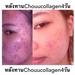 รูปย่อ อาหารเสริมเพื่อความงาม chouu collagen รูปที่2