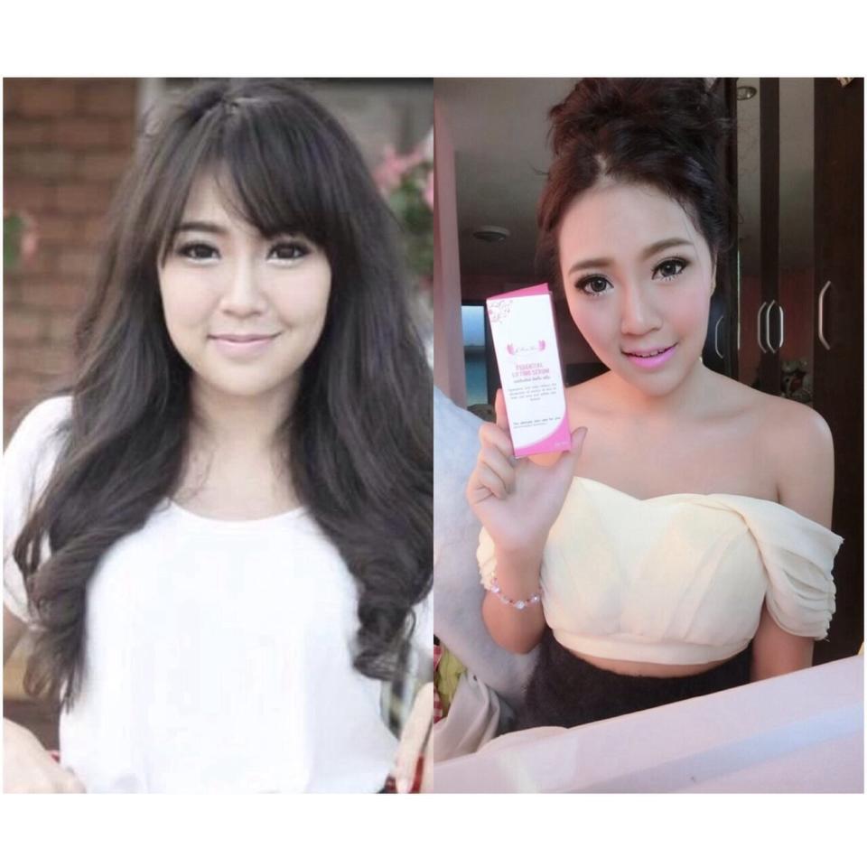 สุดยอดเซรั่มหน้าเรียว หน้าเป๊ะโดยไม่ต้องศัลยกรรม คลิ๊กเลย รูปที่ 5