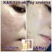 รูปย่อ ครีมพิษงู K&amp;K SYN-AKE CREAM by Crotena in KOREA ต่อต้านริ้วรอย ผิวขาวกระจ่างใส รูปที่4