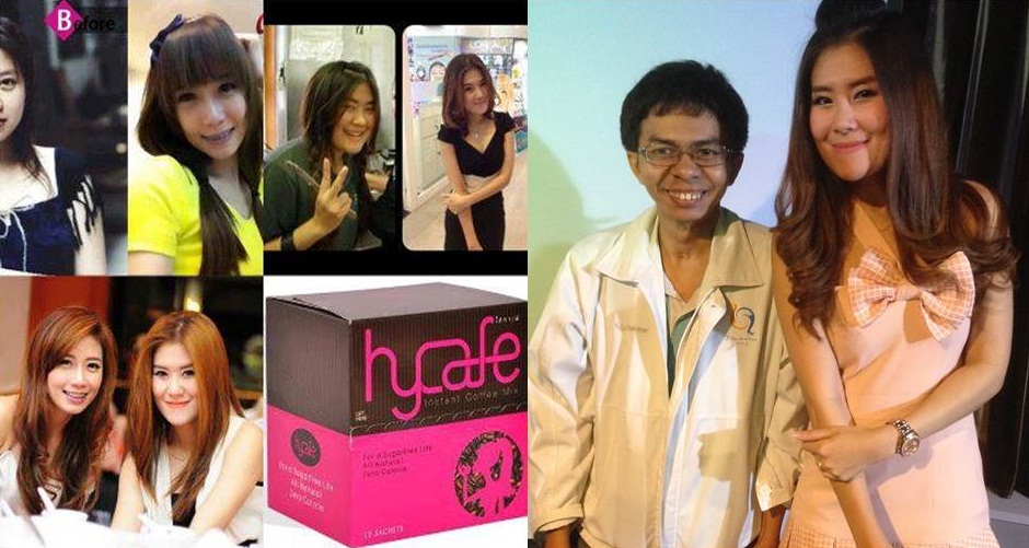 Hycafe คอลลาเจนรสกาแฟ ควบคุมน้ำหนักกระชับสัดส่วน รูปที่ 2