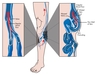 รูปย่อ ถุงน่องสุขภาพ กระชับขา ป้องกันเส้นเลือดขอด รูปที่4