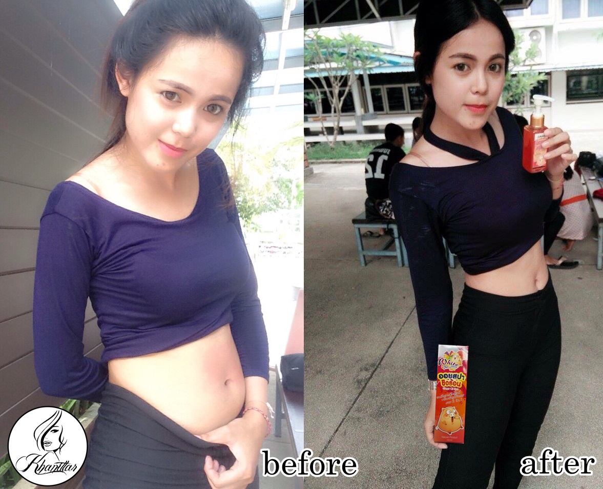 ปลีก-ส่ง ออยขิงหมูร้อน Ginger Oil Spa ลดพุง แขน ขา เรียว ไม่ต้องทาน ไม่ต้องนวด แค่ทา รูปที่ 7