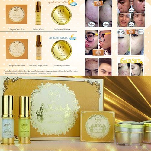 Freshy Face Gold Set โกลด์เซ็ต ครีมหน้าใส ผิวหน้าขาวใส ผิวหน้าเรียบเนียน รูขุมขนเล็กลง ลดความมันวาว รูปที่ 1