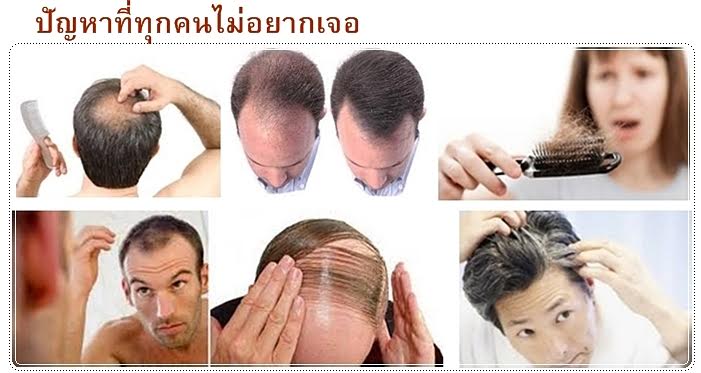 แชมพูสมุนไพรบริสุทธิ์เข้มข้นจากเกาหลี ป้องกันผมร่วง บำรุงเส้นผม ฟื้นฟูผมแห้งเสีย รูปที่ 7