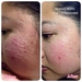 รูปย่อ Nara‬ collagen คอลาเจลนำเข้าเกรดพรีเมี่ยม ที่สำคัญมี อย. 73-2-01644-1-0005 รูปที่3