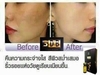 รูปย่อ 3DB เซรั่ม สเต็มเซลล์ ราคา 2,000 บาท ราคาถูก ของแท้ ส่งฟรี รูปที่4