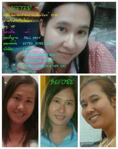 ครีมที่ใช้แล้วสิวหาย หน้าใส รีวิวrnk แท้ ไม่ปลอม ฝ้าจาง รอยดำหาย ไม่ใส่สารปรอท รูปที่ 6