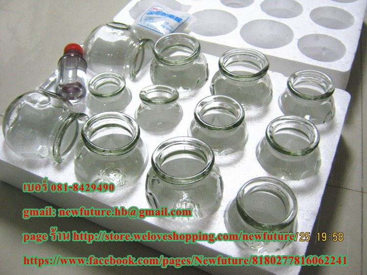 ถ้วยดูดสุญญากาศรักษาโรค ครอบแก้วสุญญากาศรรักษาโรค (Vacuum Cupping) แบบ12ถ้วยแบบแก้ว รูปที่ 1