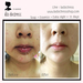 รูปย่อ Facial Cleansing Soap เฟเชียล คลีนซิง โซป (เลขจดแจ้ง 10-1-5828913) รูปที่4