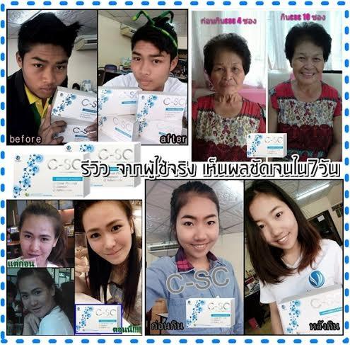 C-SC Caviar Placeta รูปที่ 7