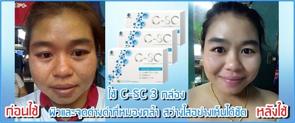 C-SC Caviar Placeta รูปที่ 4