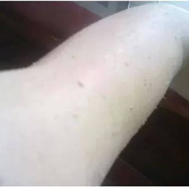คลอรีนผสมน้ำอาบ รูปที่ 5