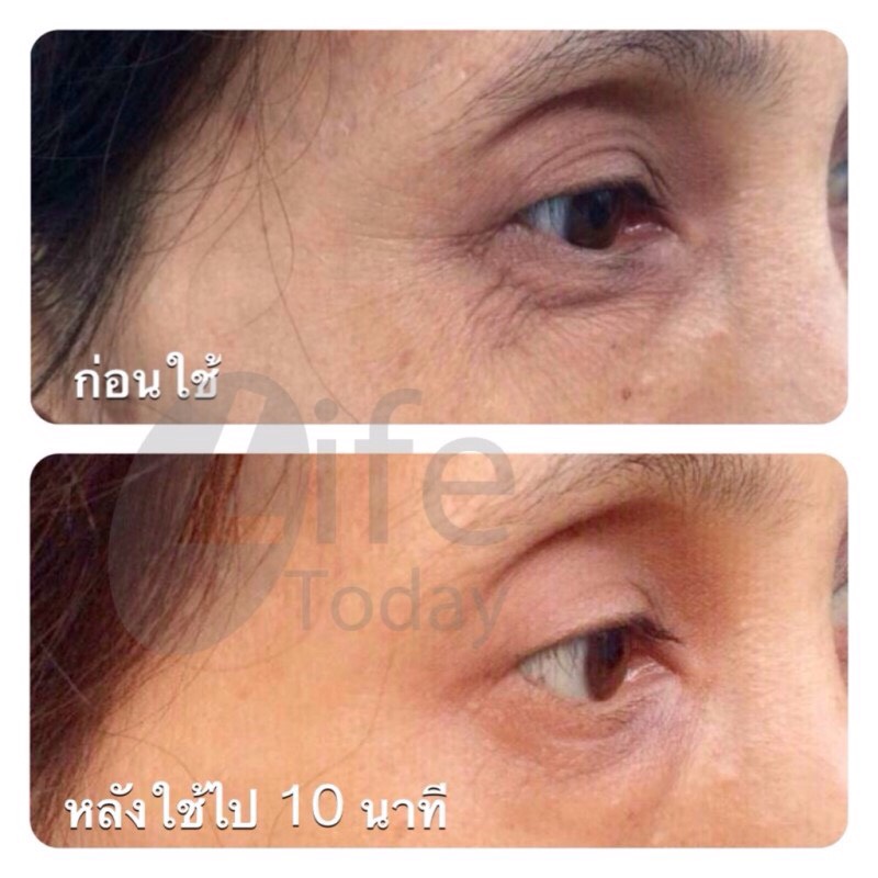 ครีมลดริ้วรอย BELL-IS (Anti-Aging) รูปที่ 1