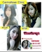 รูปย่อ รีวิวเสริมจมูก เซ็นทรัลเลเซอร์คลินิก รูปที่6