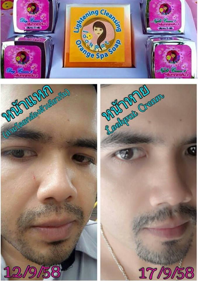 ครีมหน้าใสลูกปัด สูตรใหม่ มี อย .แพตเกจใหม่ ไฉไลกว่าเดิม เผยหน้าขาวใสไร้สิว สิวยุบแห้งไว จุดด่างดำหายเกลี้ยง รูปที่ 4