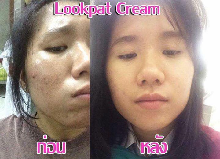 ครีมหน้าใสลูกปัด สูตรใหม่ มี อย .แพตเกจใหม่ ไฉไลกว่าเดิม เผยหน้าขาวใสไร้สิว สิวยุบแห้งไว จุดด่างดำหายเกลี้ยง รูปที่ 3