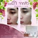 รูปย่อ New Product NC24 opc Grapeseed+vitc อร์ส ทำหน้าใส อมชมพู ได้ ด้วย ตัวเอง ง่ายๆ ที่บ้าน!! ผิวขาวใส อมชมพู รักษาสิวทุกชนิด รูปที่3