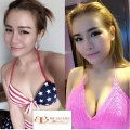 ศัลยกรรมหน้าอก ขายศัลยกรรมหน้าอก ราคาศัลยกรรม bb clinicติดต่อแมวพยาบาล 0653545163 รูปที่ 2