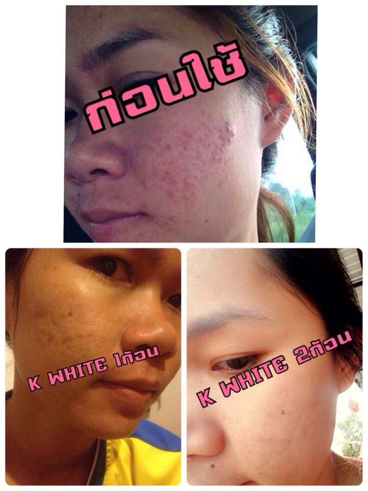 สบู่สคลับชาโคล รูปที่ 5
