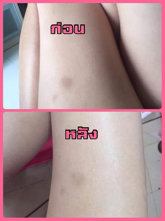 สบู่ฟอกผิวขาวสคลับชาโคล รูปที่ 6