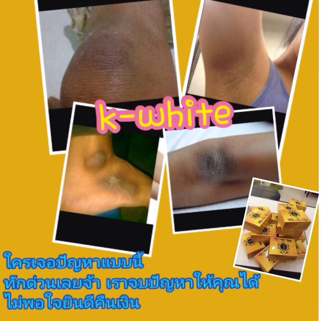 สบู่สคลับชาโคล รูปที่ 2