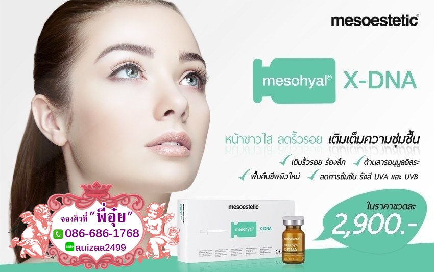 Mesohyal X-DNA รูปที่ 1