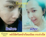 รูปย่อ ครีมกานาโกะ อินเทนซีฟยูวีไวท์เทนนิ่ง Ganako Intensive UV Whitening Cream รูปที่6