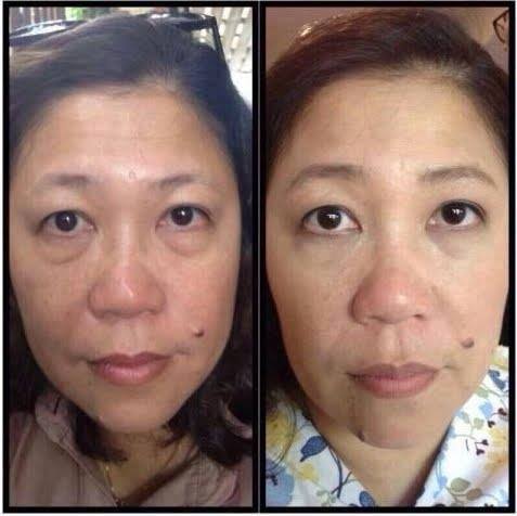 ครีมลบถุงใต้ตาและริ้วบนใบหน้า ยุบหายภายใน2-3 นาที รูปที่ 7