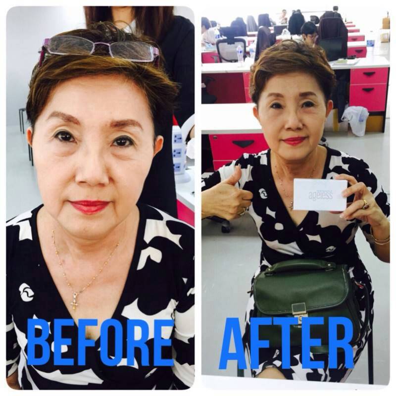 ครีมลบถุงใต้ตาและริ้วบนใบหน้า ยุบหายภายใน2-3 นาที รูปที่ 4