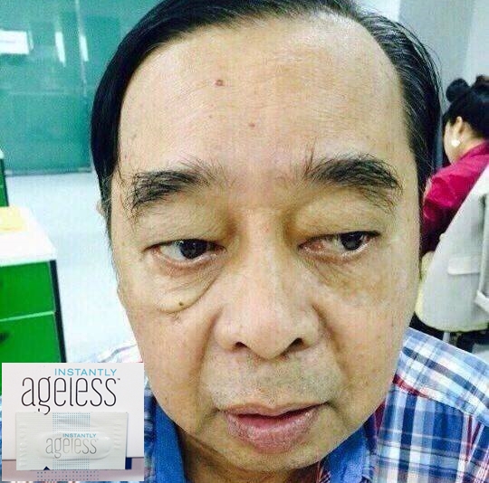 ครีมลบถุงใต้ตาและริ้วบนใบหน้า ยุบหายภายใน2-3 นาที รูปที่ 5