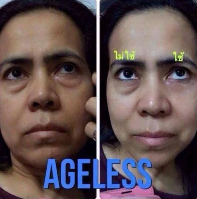 ครีมลบถุงใต้ตาและริ้วบนใบหน้า ยุบหายภายใน2-3 นาที รูปที่ 3