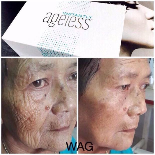 ครีมลบถุงใต้ตาและริ้วบนใบหน้า ยุบหายภายใน2-3 นาที รูปที่ 6