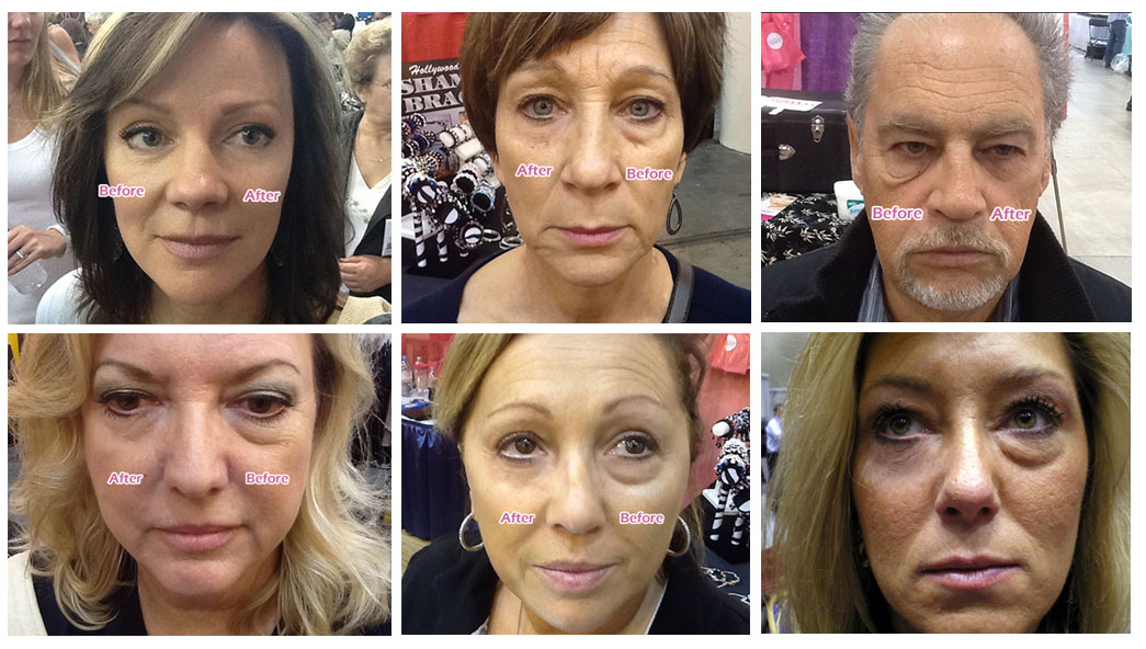 Instantly Ageless สุดยอดครีมลดถุงใต้ตา รูปที่ 7