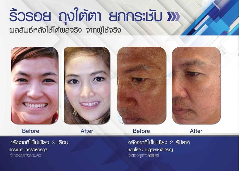 ชุดผลิตภัณฑ์ Luminesce ชุดครีมหน้าเด็ก รูปที่ 6