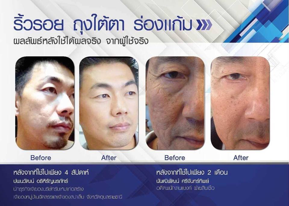 ชุดผลิตภัณฑ์ Luminesce ชุดครีมหน้าเด็ก รูปที่ 7