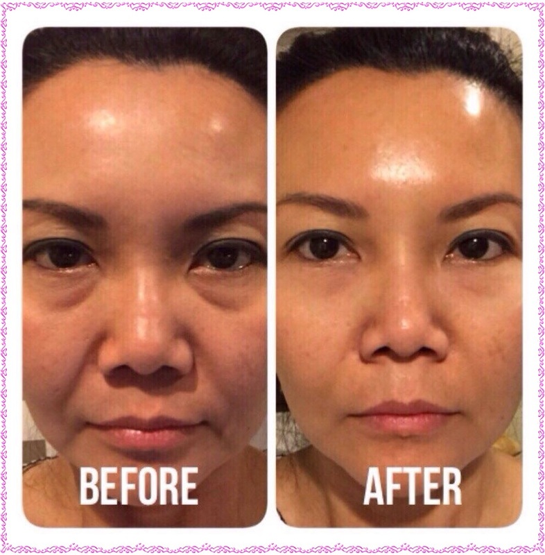 Instantly Ageless สุดยอดครีมลดถุงใต้ตา รูปที่ 5